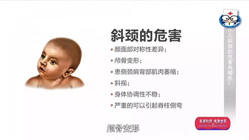 山东省立医院专家提醒:警惕小儿斜颈