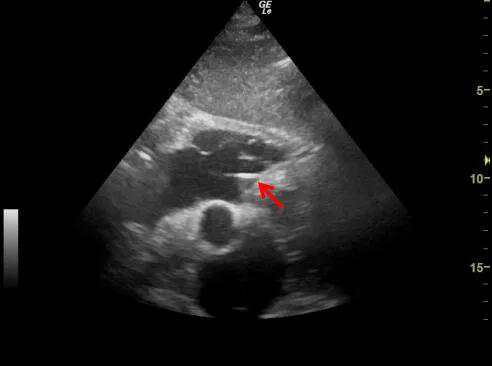 微信图片_20200519075639.jpg 微信图片_20200519075639.jpg