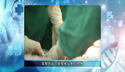 【医院电视专栏:百年省医】拯救被扯断的胳膊