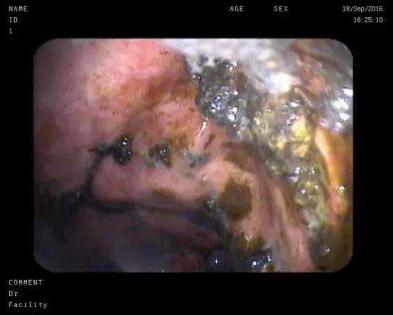 图片5.jpg 图片5.jpg