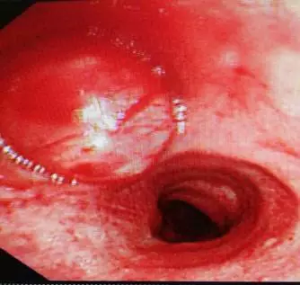 QQ图片20170728133415.png QQ图片20170728133415.png