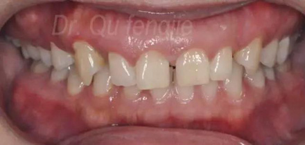 微信图片_20170829093251.jpg 微信图片_20170829093251.jpg