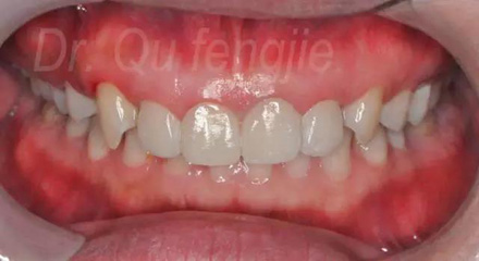 微信图片_20170829093255.jpg 微信图片_20170829093255.jpg