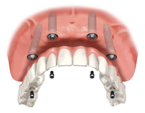 图片43.jpg 图片43.jpg