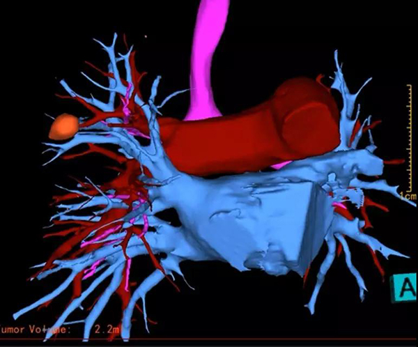 微信图片_20181106093838.jpg 微信图片_20181106093838.jpg