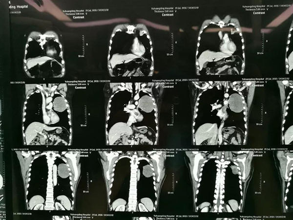 微信图片_20181107093820.jpg 微信图片_20181107093820.jpg