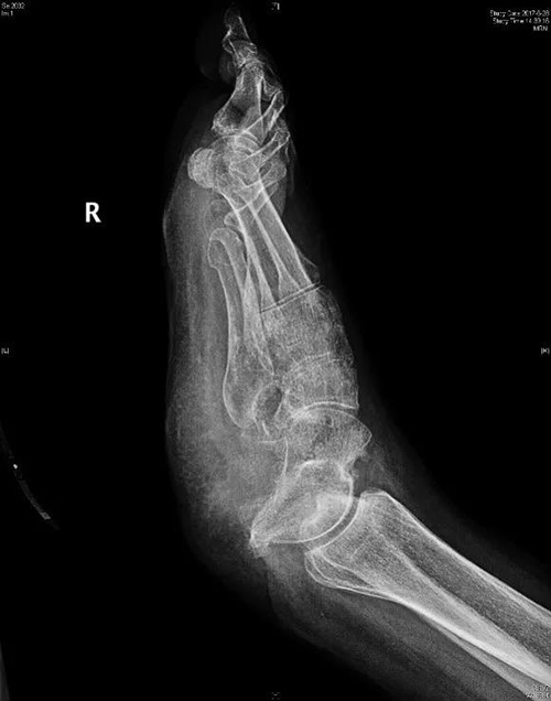 微信图片_20181107100758.jpg 微信图片_20181107100758.jpg