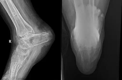 微信图片_20181107100816.jpg 微信图片_20181107100816.jpg