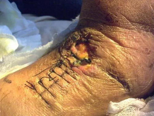 微信图片_20181107112311.jpg 微信图片_20181107112311.jpg