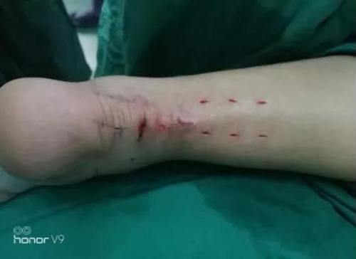 微信图片_20181107112336.jpg 微信图片_20181107112336.jpg