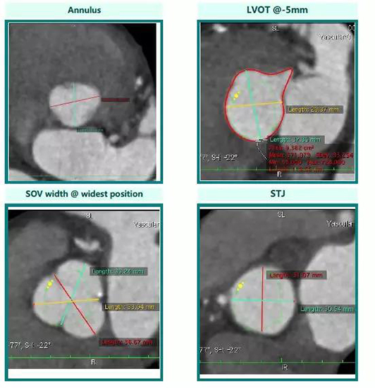 微信图片_20181107113334.jpg 微信图片_20181107113334.jpg
