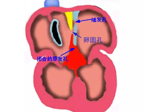 圆孔卵圆孔图片