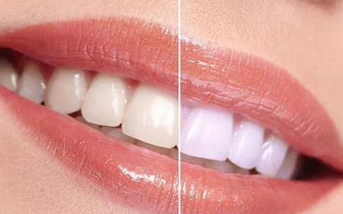 微信图片_20190508102907.jpg 微信图片_20190508102907.jpg