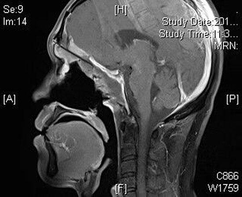 微信图片_20190905094410.jpg 微信图片_20190905094410.jpg