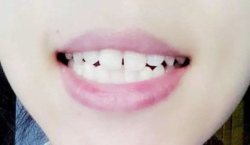 图片3.jpg 图片3.jpg