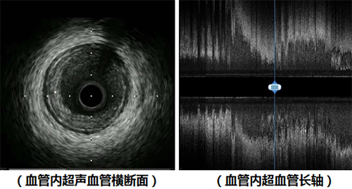 心肌横断面图片