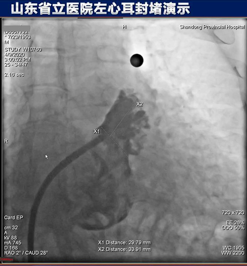 微信图片_20200414090256.jpg 微信图片_20200414090256.jpg