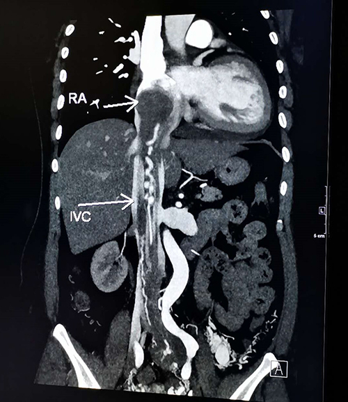 微信图片_20200617074711.jpg 微信图片_20200617074711.jpg