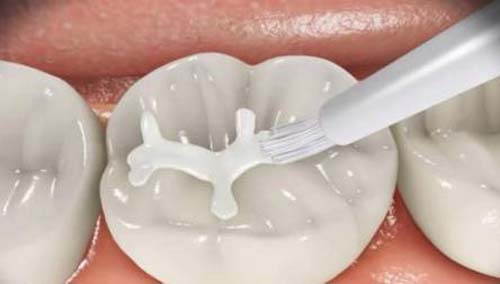 图片14.jpg 图片14.jpg