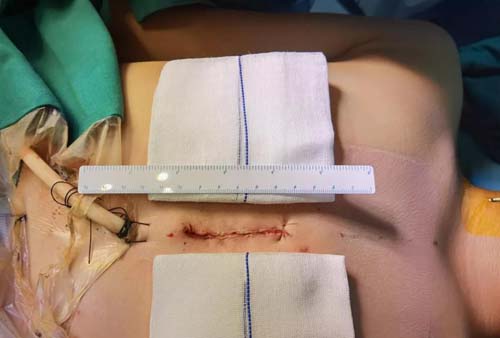 微信图片_20201112091146.jpg 微信图片_20201112091146.jpg