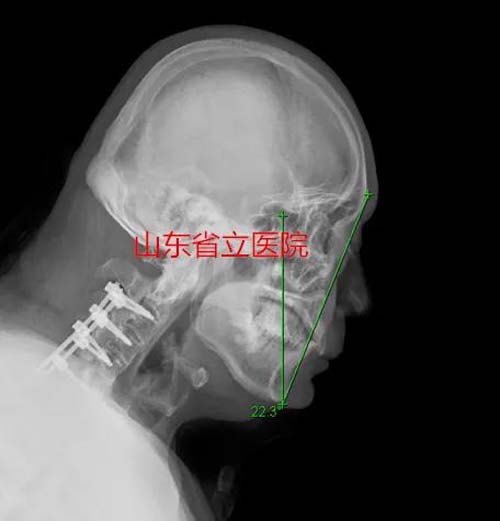 微信图片_20210402093635.jpg 微信图片_20210402093635.jpg