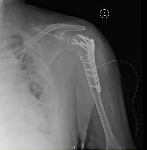 微信图片_20210611091915.jpg 微信图片_20210611091915.jpg