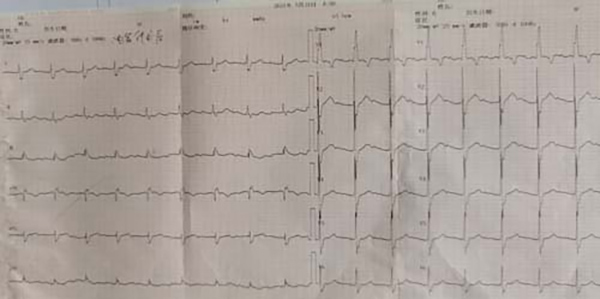图片 3.jpg 图片 3.jpg