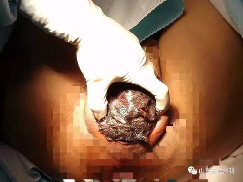 图片9.jpg 图片9.jpg