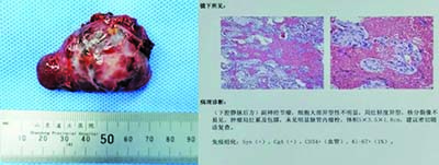 sl2105105.jpg