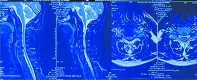 sl2211d.jpg