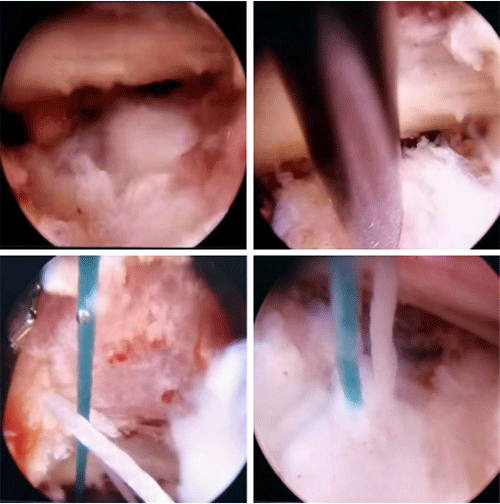 微信截图_20230313092547.gif 微信截图_20230313092547.gif