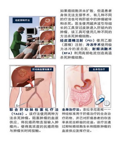 图片 4.jpg