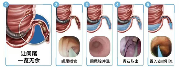 图片14.jpg 图片14.jpg