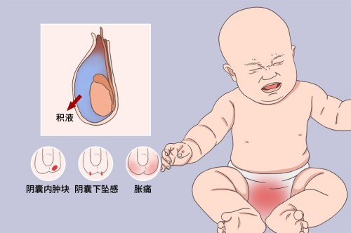 图片 3(1).jpg 图片 3(1).jpg