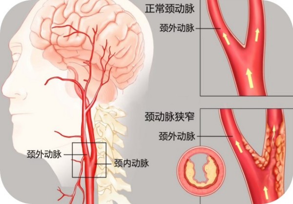 图片 1.jpg 图片 1.jpg