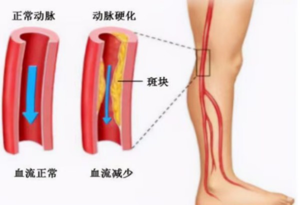 图片 1.jpg 图片 1.jpg