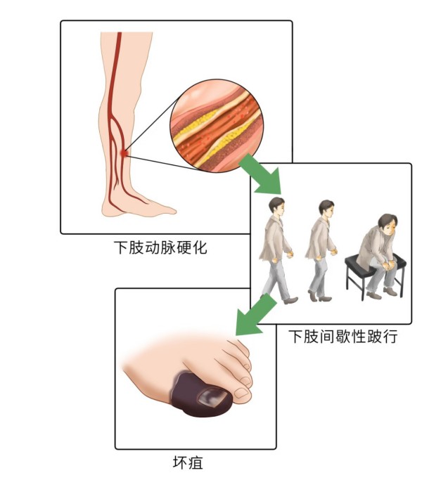 图片 2.jpg 图片 2.jpg