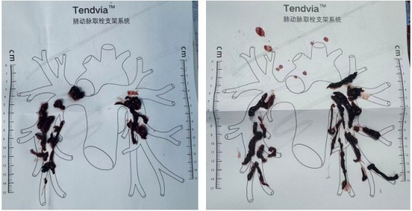 图片 2.jpg 图片 2.jpg