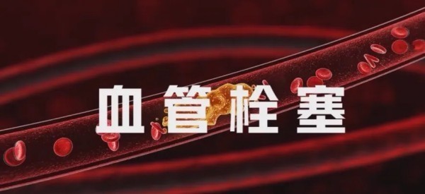 图片 1.jpg 图片 1.jpg