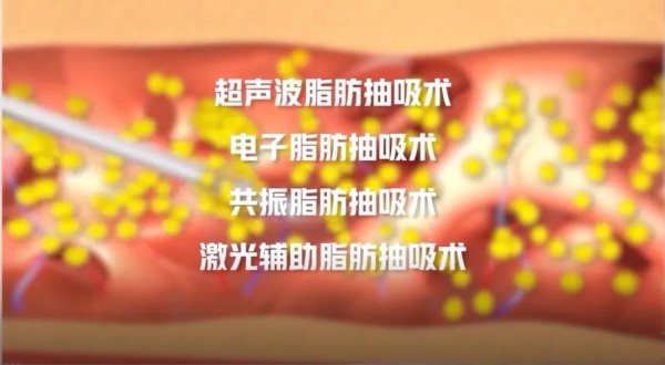 图片 3.jpg