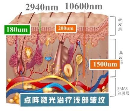 图片 4.jpg
