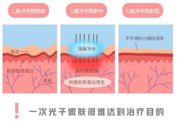 图片 3.jpg 图片 3.jpg