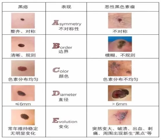图片 2.jpg 图片 2.jpg