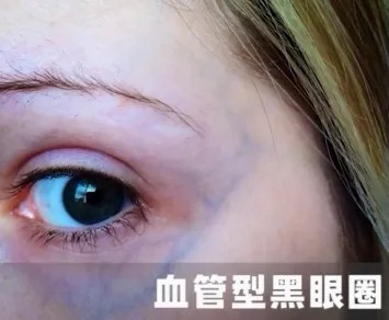 图片 3.jpg 图片 3.jpg