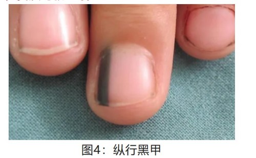 图片 4.jpg 图片 4.jpg