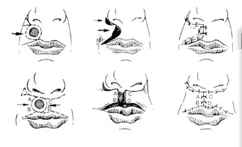 图片 1.jpg 图片 1.jpg