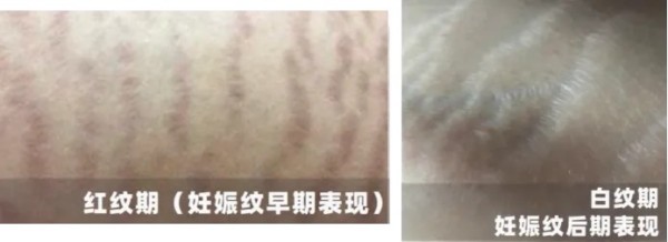 图片 3.jpg 图片 3.jpg