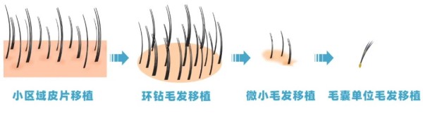 图片 2.jpg 图片 2.jpg