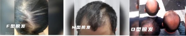 图片 4.jpg 图片 4.jpg