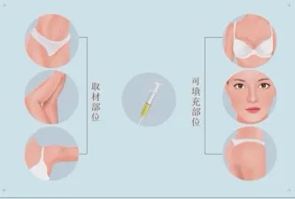 图片 2.jpg 图片 2.jpg